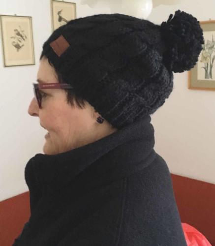 Sometimes I just stick it under a beanie and wait for it to grow again